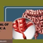 The Plural of Appendix: A Friendly Guide